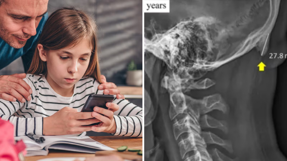 Can Smartphone Use Really Cause “Horns” to Grow on the Skull? What Science Actually Says